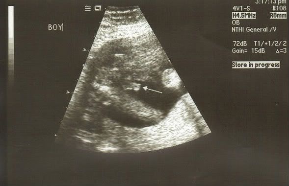 ultrasound images of girls and boys. Honestly, I didn't think that my side of the family could produce boys.
