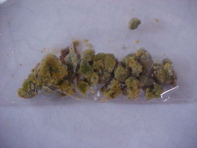 http://i48.photobucket.com/albums/f204/qwkstng/my-gallstone-2.jpg