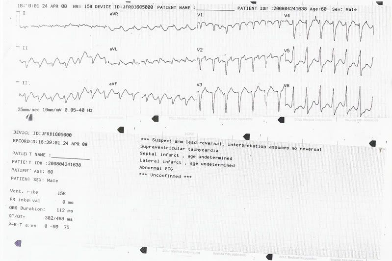 EKG.jpg
