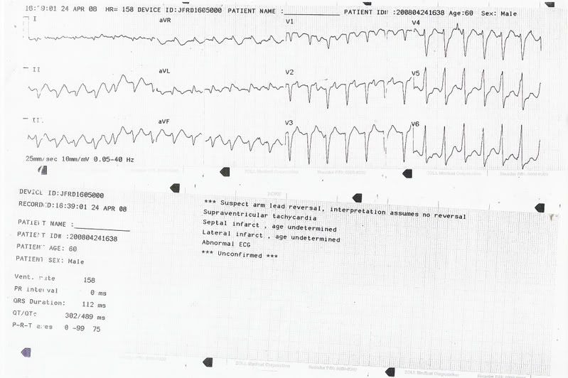 EKG.jpg?t=1209155084